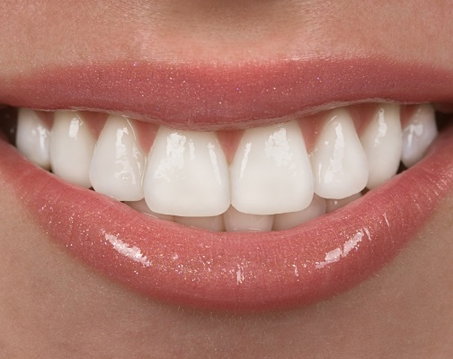 Close up of smile with straight white teeth