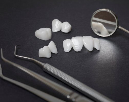 Dental veneers and crowns on table next to dental mirror