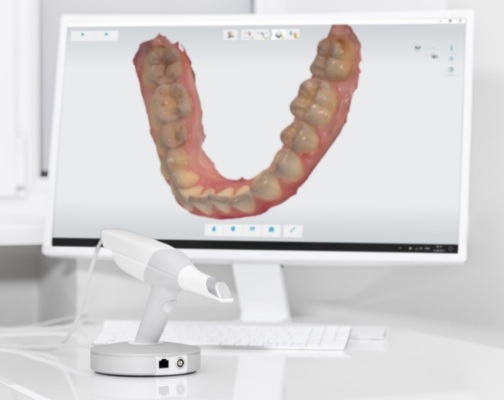 Digital model of row of teeth on computer monitor