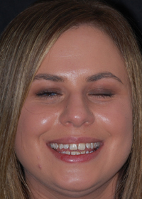 woman smiling before