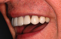 Man with glasses smile after