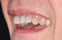 man with glasses smile before