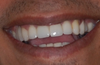 young male's smile after