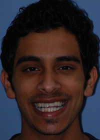 young male before