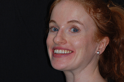 Young woman smiling after straightening her teeth with Invisalign in Brookline