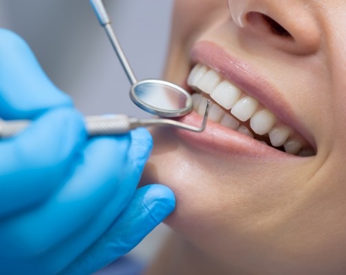 Close up of dental patient having their mouth examined