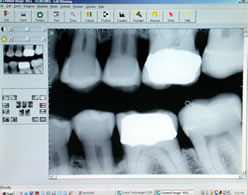 digitalxray