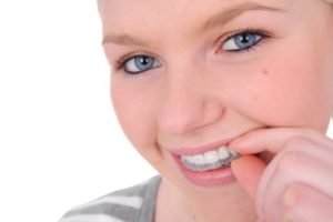 woman with clear aligner