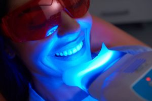Zoomed in view of woman smiling wearing protective glasses with blue light in front of her teeth
