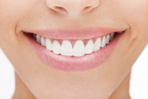 porcelain veneers can bring your smile beauty.