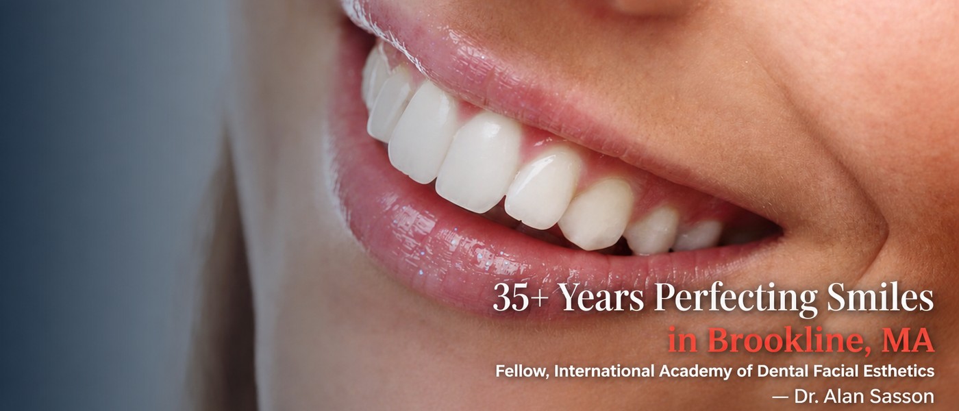 Close-up of porcelain veneers smile, Boston Smile Center Brookline MA - 35 plus years of cosmetic dentistry experience